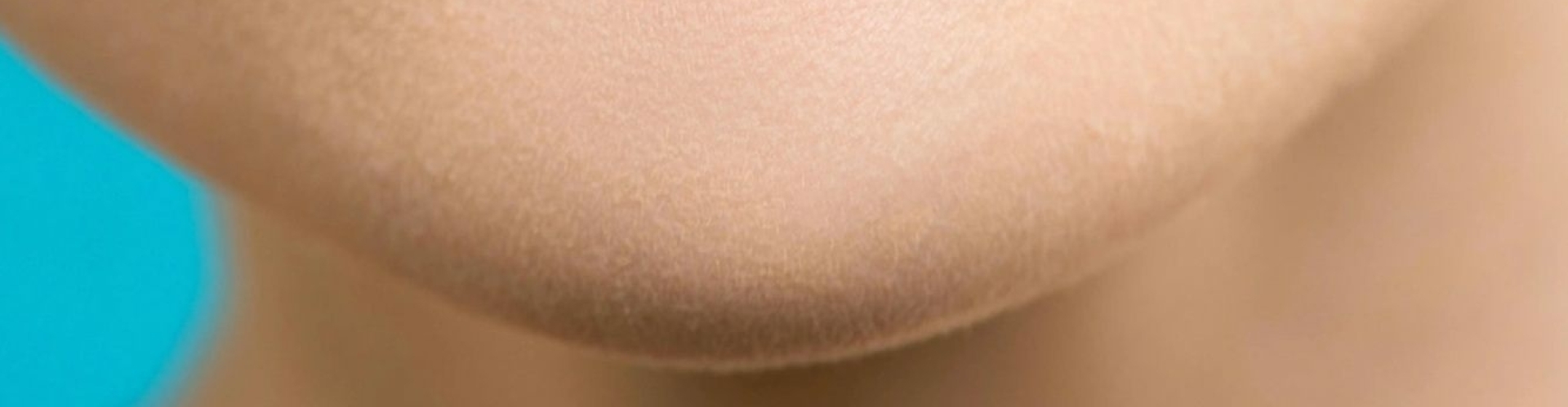 laser ontharingsbehandeling kin