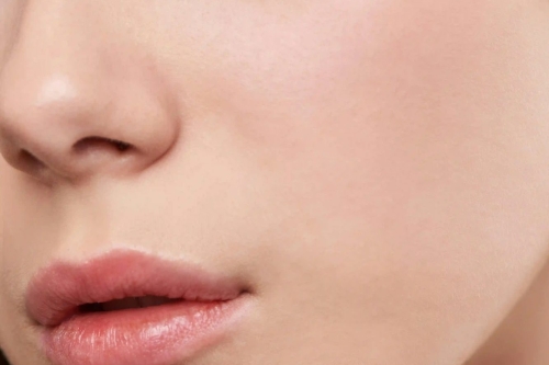 laser ontharingsbehandeling wangen