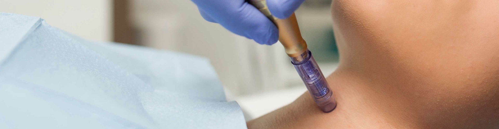 microdermabrasie behandeling