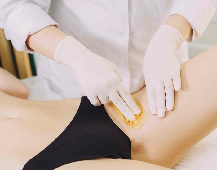 Bikinilijn harsen Rotterdam