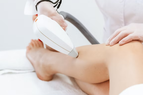 Laser ontharing Zayn Skincare