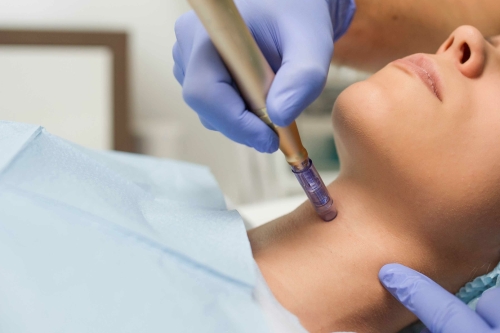 microdermabrasie behandeling