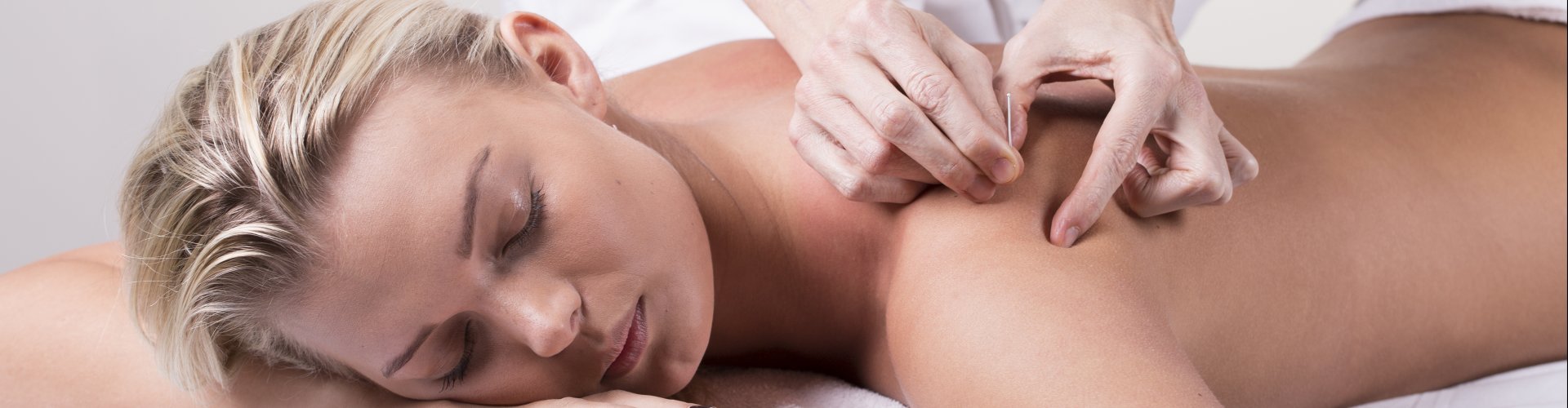 Ontspannende werking van acupunctuur Ontspannen vrouw tijdens acupunctuurbehandeling