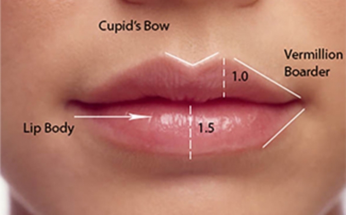 lippen opvullen den haag volle lippen dikke lippen botox lippen lipfillers lipvergroting hyaluronzuur fillers den haag