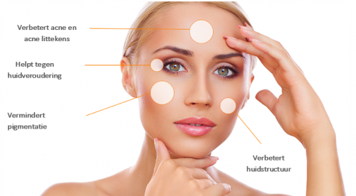 tca peeling den haag tca peeling den haag