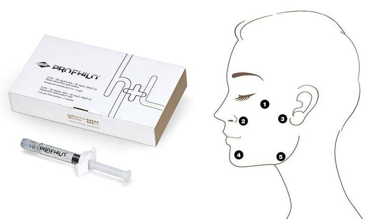 Profhilo Profhilo den haag profhilo behandeling den haag