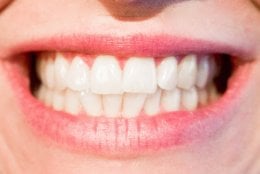 Hoeveel sessies er nodig zijn voor de behandeling tegen het tandenknarsen