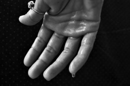 Zweten en blozen oplossen met hypnose en hypnotherapie Nooit meer last van blozen en zweten door hypnotherapie