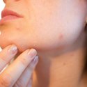 Acné, huidproblemen, Rosacea Hulp Orthomoleculair Therapeut Lelystad en Online - JouwVitaliteitscoach.nl Acné, huidproblemen, Rosacea Hulp Orthomoleculair Therapeut Lelystad en Online - JouwVitaliteitscoach.nl