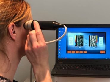 Huidscan echo collageen