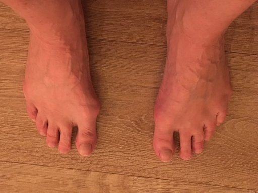 Resultaat Voetentraining Online Training Scheve Teen Resultaat Voetentraining Online Training Scheve Teen