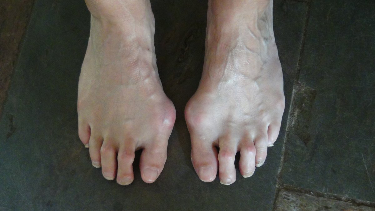 Resultaat Voetentraining 2 Resultaat Voetentraining Online Training Scheve Teen