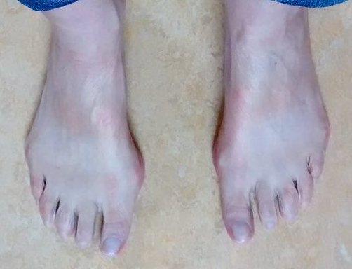 Resultaat Voetentraining Online Training Scheve Teen Resultaat Voetentraining Online Training Scheve Teen