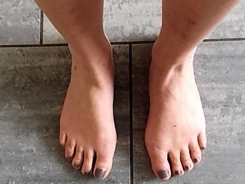 Resultaat Voetentraining Online Training Scheve Teen Resultaat Voetentraining Online Training Scheve Teen