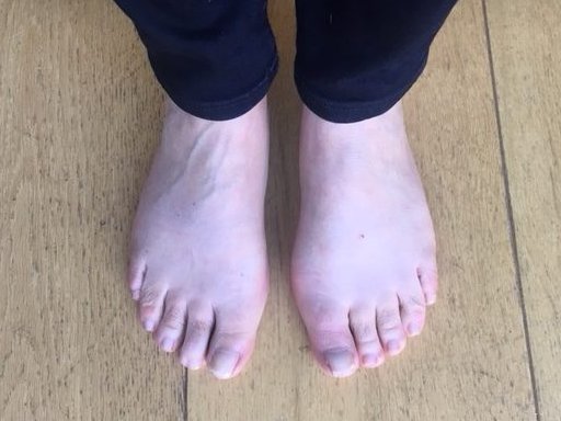 Resultaat Voetentraining Resultaat Voetentraining Online Training Scheve Teen