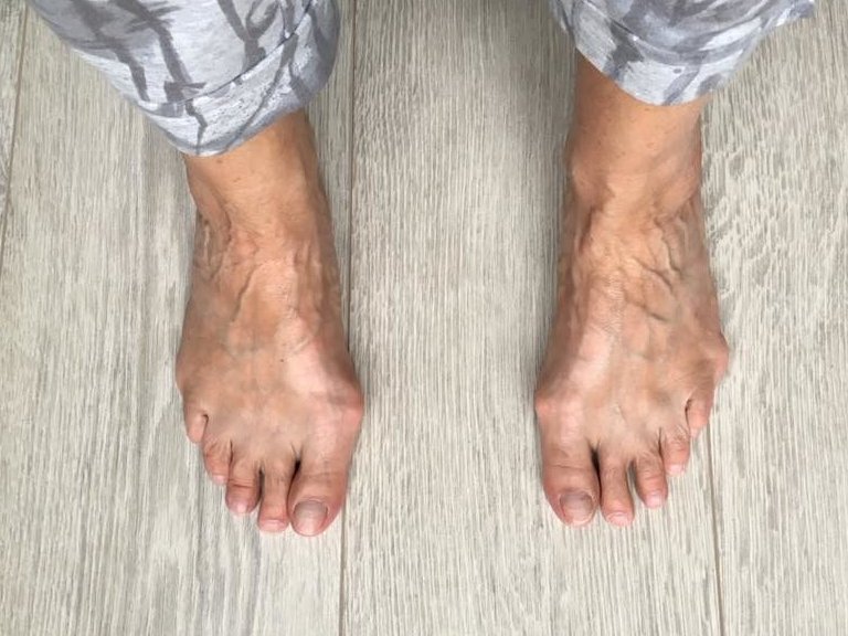 Resultaat Voetentraining Online Training Scheve Teen Resultaat Voetentraining Online Training Scheve TeenResultaat Voetentraining