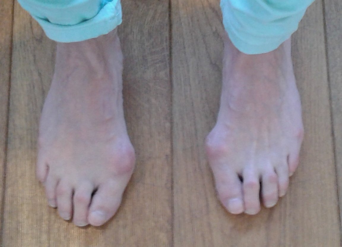 Resultaat Voetentraining Resultaat Voetentraining Online Training Scheve Teen