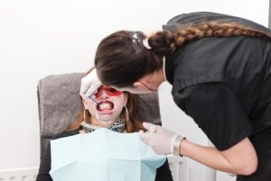tanden bleken bruiloft